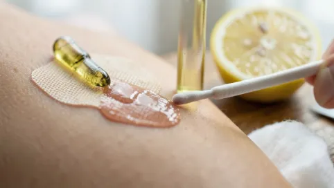 czym zmyć klej po plastrze domowym sposobem